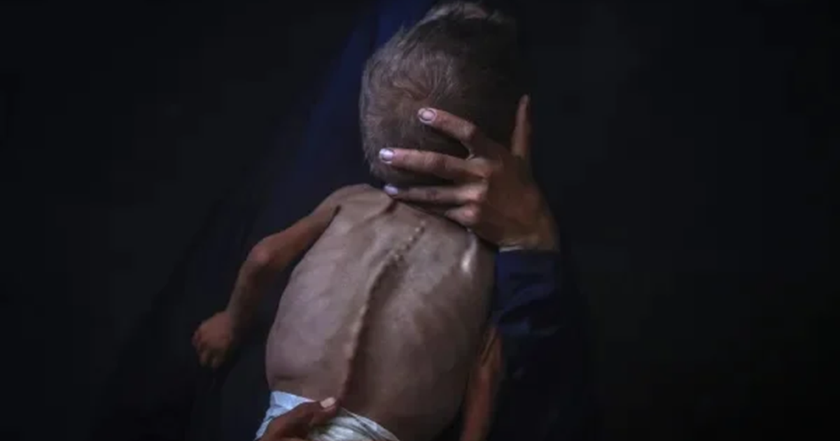 "الميزان" يطالب بالشروع في خطط التعافي وإعادة الإعمار للحد من تفشي الفقر المدقع في قطاع غزة