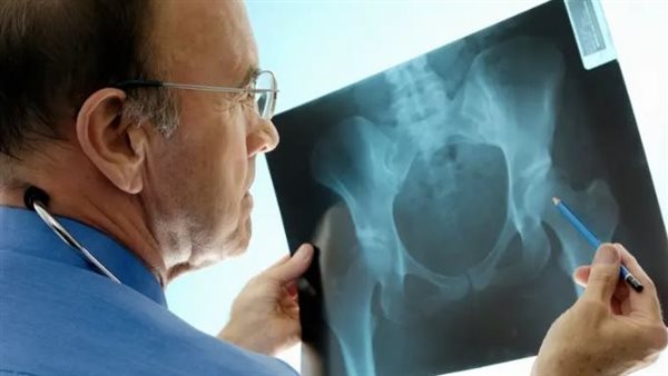 6 أطعمة هندية تُعزز قوة العظام خلال 30 يومًا