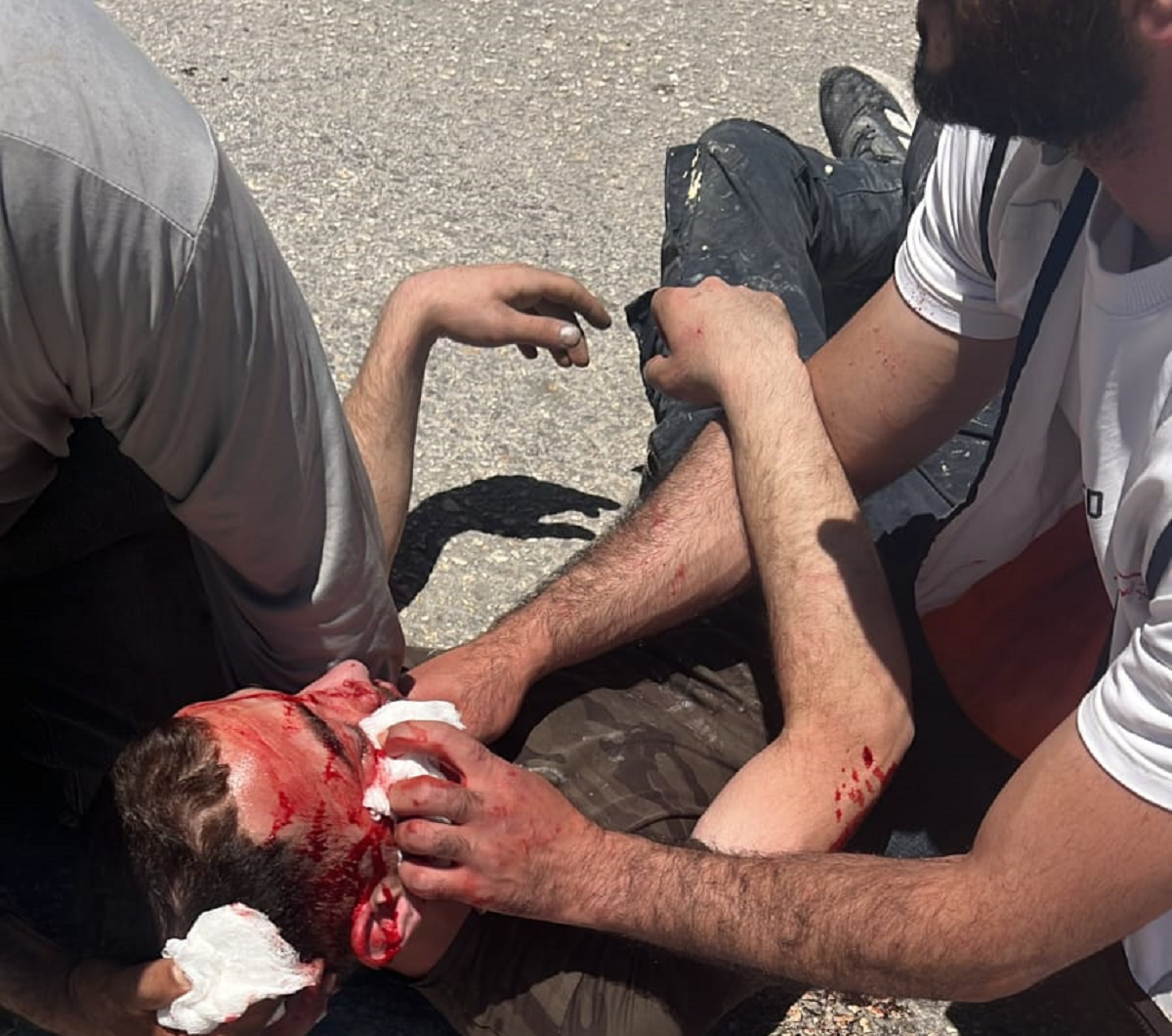 إصابات وسرقة مركبات وأغنام والاعتداء على منازل في هجوم المستوطنين على حوارة