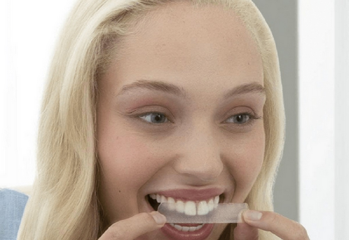  تعرف على طريقة لاصقات تبييض الأسنان