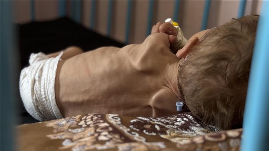 اليونيسف: طفل من كل 5 بغزة يعاني من نقص بالوزن عند الولادة