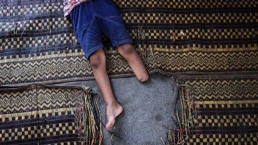 الصحة في غزة: 5 آلاف حالة بتر و10 آلاف بحاجة لتأهيل طويل الأمد